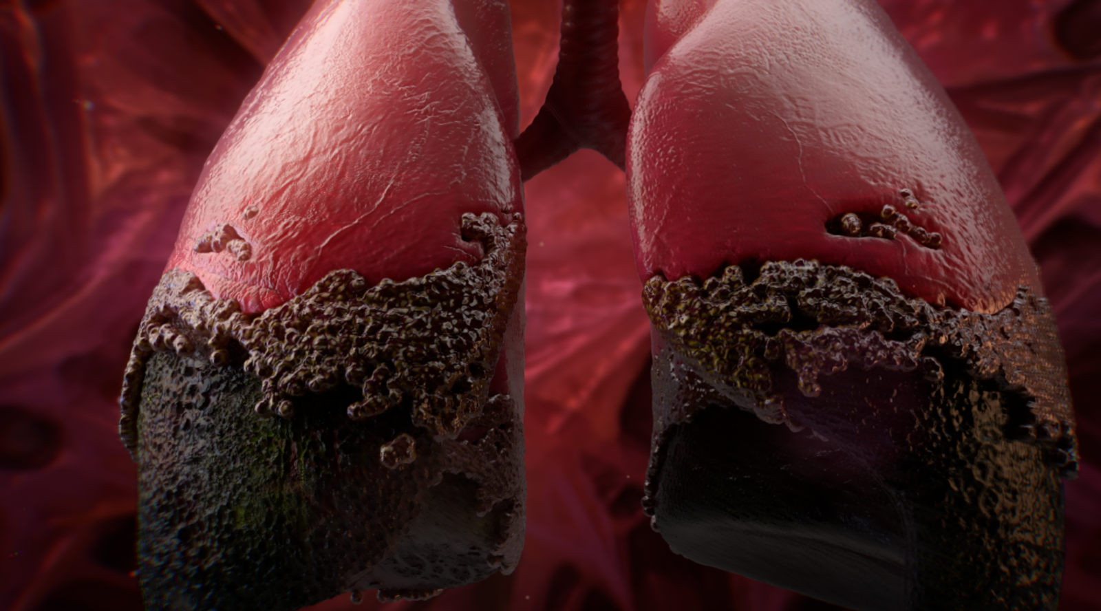pulmones.png